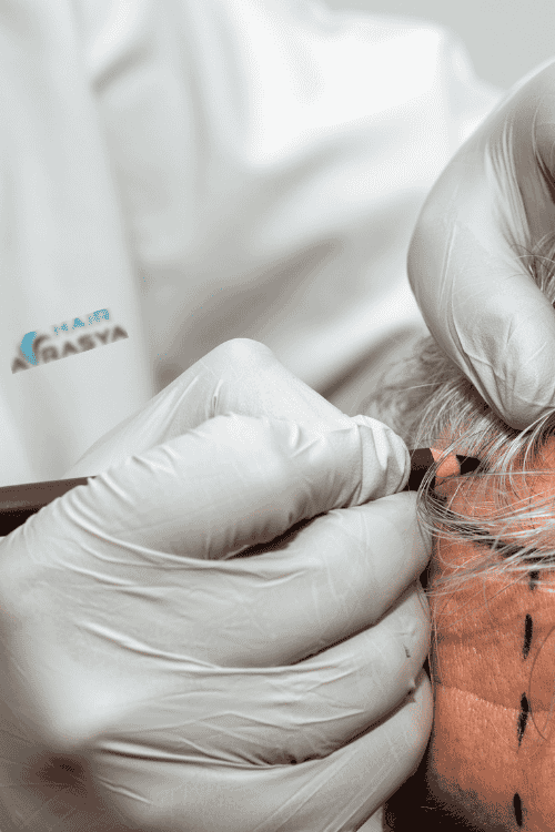 | Hairavrasya Hair Transplant