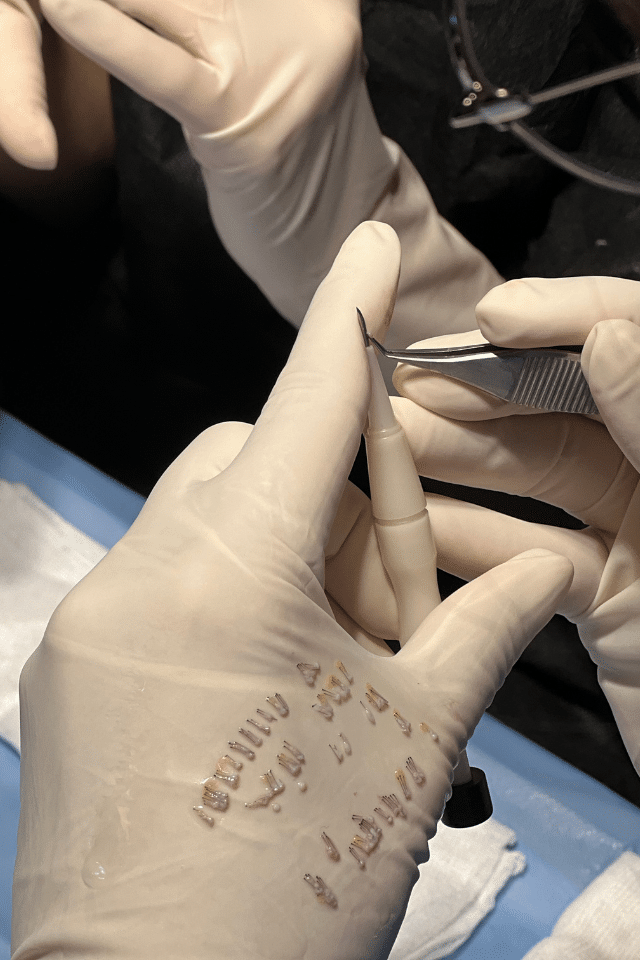 | Hairavrasya Hair Transplant